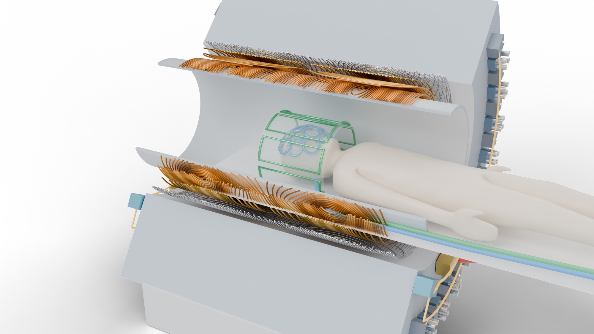 Cutaway of an MRI magnet showing the gradient array windings, a transmit array and a receive array around the patient's head