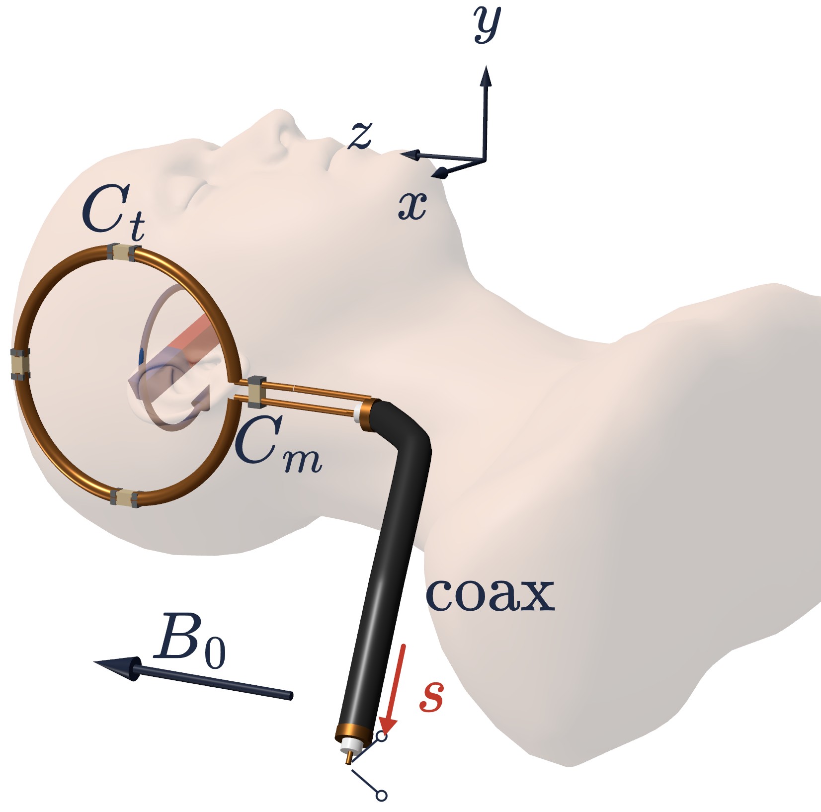 A head with a surface receive coil on its side, the coil's tuning and matching capacitors, and the coax carrying the signal to the receiver